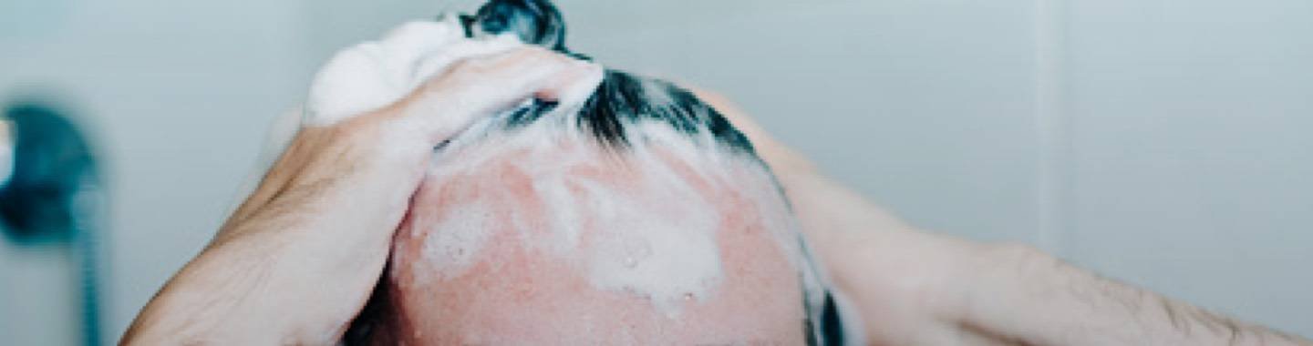 scalp-header_banner